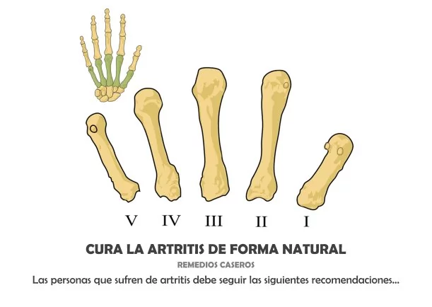 Imagen del escrito; Cura la artritis de forma natural, de Jbn Lie